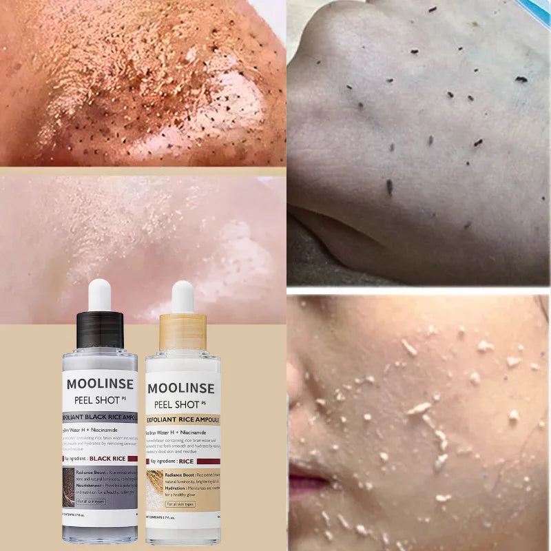 SERUM EXFOLIANTE DE ARROZ